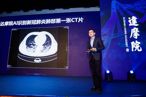 中国科技馆收录数字抗疫藏品 阿里达摩院首张AI识别新冠CT入选