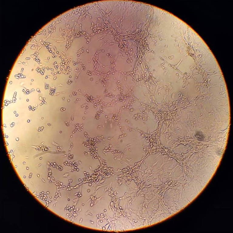 △显微镜下可见细胞感染猴痘病毒后的图像变化过程 来源：奥斯瓦尔多·克鲁兹基金会